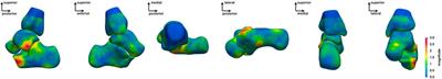Comprehensive personalized ankle joint shape analysis of children with cerebral palsy from pediatric MRI